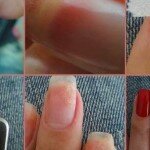 Como Recuperar Unhas Quebradas