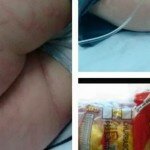 Alerta de Saúde – Salgadinhos