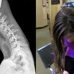 Ela queixava-se de dores no pescoço. O que os médicos descobriram é um pesadelo!
