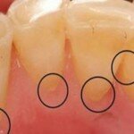 Resolva a maioria dos problemas dentários em casa! Vai poupar muito dinheiro!