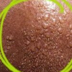 Conheça 12 sinais de deficiência de vitamina D