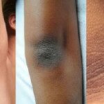 Guia: Axilas, joelhos e cotovelos escuros