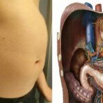 Receitas naturais contra o inchaço