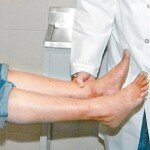 14 sinais importantes de que você tem má circulação no sangue! Veja…