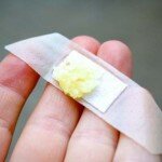 Ela colocou alguns pedaços de alho picado em um Band-aid – veja o que aconteceu