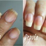 Aprenda a fazer suas unhas crescerem em apenas 3 dias