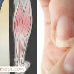 Cabelo Ressecado? Unhas Quebradiças? Dor de Cabeça? Você pode estar com Deficiência destas Vitaminas