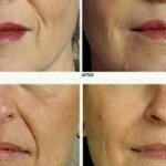 Creme Anti-Idade Caseiro com apenas 3 Ingredientes para combater rugas e flacidez