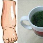 Este é o melhor Remédio caseiro para Pernas inchadas e para limpar os Rins