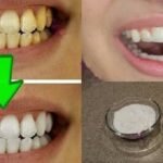 Clareie seus dentes em menos de 3 minutos