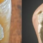 Receita Natural para dor nos joelhos, costas e articulações