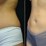 14 dias – apenas 14 dias! – para você secar a barriguinha com esta incrível dieta