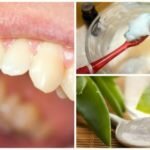 Elimine a placa bacteriana com estes interessantes remédios naturais