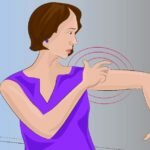 8 sintomas de AVC que as mulheres particularmente deveriam ficar atentas.