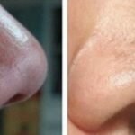 7 Usos do Bicarbonato de Sódio que vão deixar você muito mais Bonita!