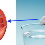 Como limpar seus Rins e eliminar o Ácido Úrico com apenas meia colher de um único ingrediente!