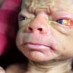 Quando os médicos viram o bebê, eles prenderam o fôlego: ele parecia um homem de 80 anos!