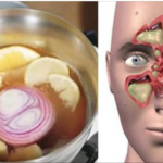 Esta é a “Bomba” contra a Congestão Nasal e a gripe – Vai curar você em 24 horas!