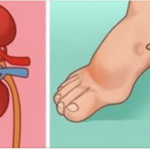 Um Mês antes do Derrame ocorrer, Seu corpo envia estes Sinais: Não ignore nenhum deles!