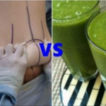 Lipoaspiração x Perda de peso natural – Esta receita é a prova de que é possível emagrecer naturalmente!