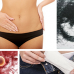 A Cor do Sangue da sua Menstruação pode Revelar Graves problemas de Saúde