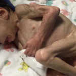 Esta mulher adotou um menino órfão de 7 anos que pesava apenas 4,5kg. Um ano depois, ele está completamente irreconhecível!