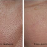9 dicas para fechar os poros do seu rosto dando uma renovada no visual