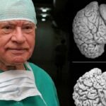 ​Neurocientistas dão uma Notícia Alarmante, Mulheres tenham muita Atenção!