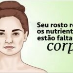 5 Sinais de Carência de Vitaminas e Minerais que podem aparecer no seu Rosto!
