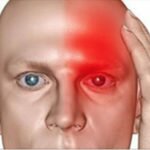 10 Sinais que Indicam que a Pessoa está tendo um Derrame – E Receitas Naturais para evitar o Problema!
