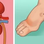 8 avisos do seu corpo antes de um acidente vascular cerebral – Sintomas que todos devemos conhecer